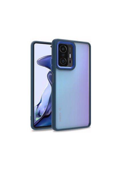 Xiaomi Mi 11T 5g Kılıf Arkası Şeffaf Kenarları Renkli Bergen Kapak