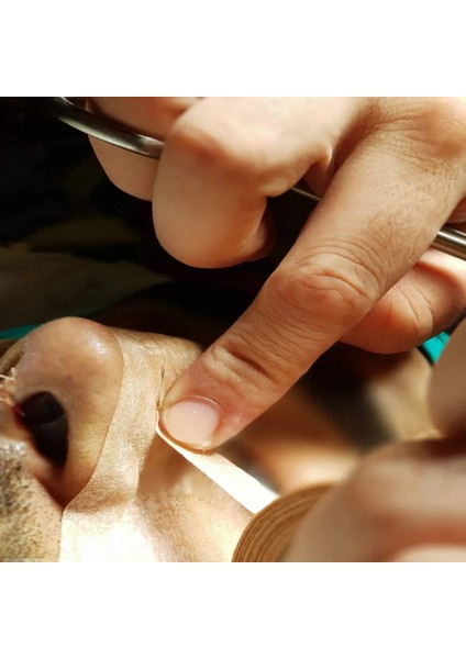 Micropore Estetik Burun Bandı