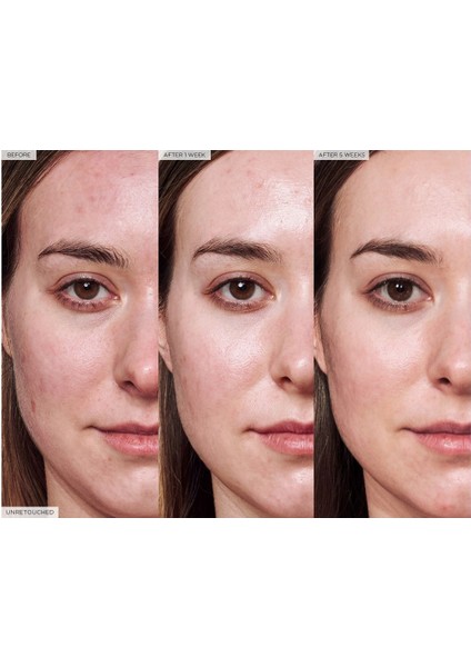 Glow Recıpe Avocado Ceramide - Cilt Bariyerini Güçlendirme Etkili Serum 30 ml modelleri