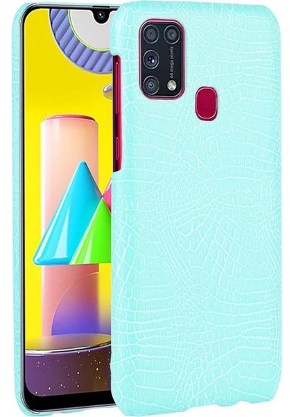 Samsung Galaxy M31 Koruyucu Kapak Için Şık Klasik Kılıf Klasik Anti (Yurt Dışından)