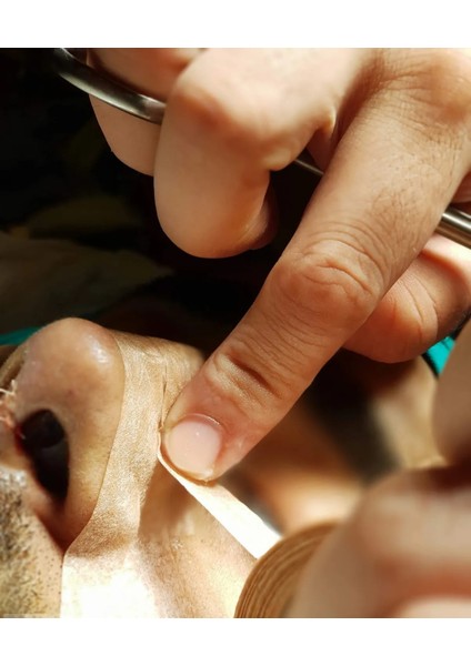 Micropore Estetik Burun Bandı 3 Adet