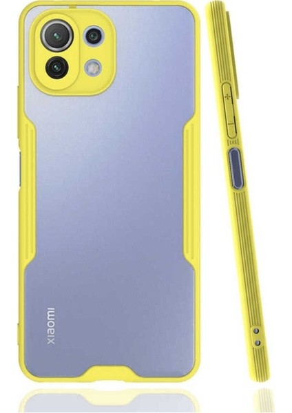 Xiaomi Mi 11 Lite Uyumlu Kılıf Parfe Kapak, Sarı