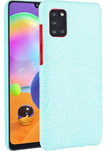 Samsung Galaxy Stylish Klasik Timsah Moda Anti Için Şık Klasik Kılıf (Yurt Dışından)