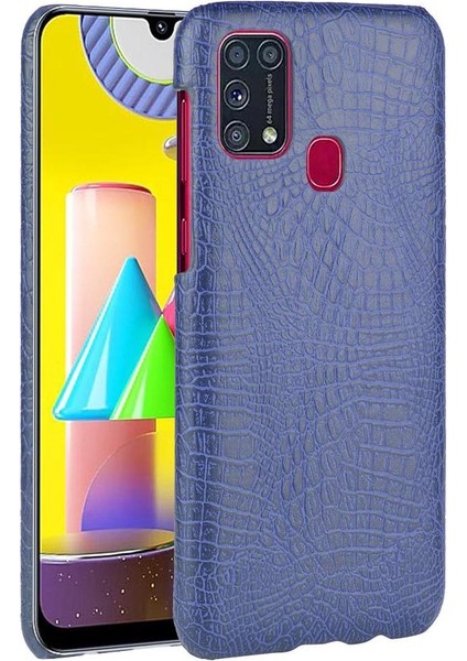 Samsung Galaxy M31 Telefon Kılıfı (Yurt Dışından)