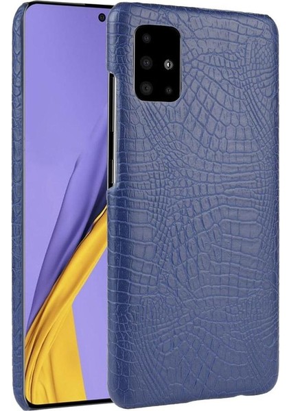 Samsung Galaxy A71 5g Uyumluluk Anti Scratch Için Şık Klasik Kılıf (Yurt Dışından)
