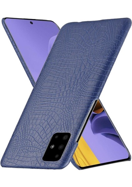 Samsung Galaxy A71 5g Uyumluluk Anti Scratch Için Şık Klasik Kılıf (Yurt Dışından) fiyatları