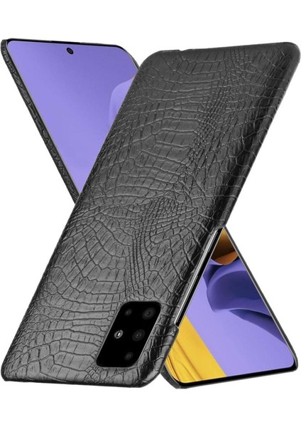 Samsung Galaxy A71 5g Uyumluluk Anti Scratch Için Şık Klasik Kılıf (Yurt Dışından) indirimleri