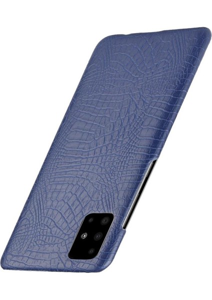 Samsung Galaxy A71 5g Uyumluluk Anti Scratch Için Şık Klasik Kılıf (Yurt Dışından) indirimleri
