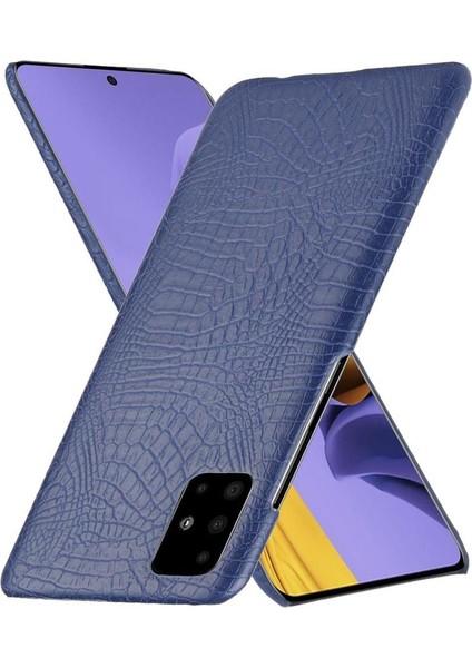 BDT Boutique Samsung Galaxy M51 Klasik Timsah Moda Anti Için Şık Klasik Durumda (Yurt Dışından)