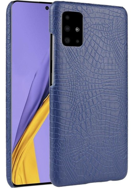 Manyi Mall Samsung Galaxy M51 Telefon Kılıfı (Yurt Dışından)