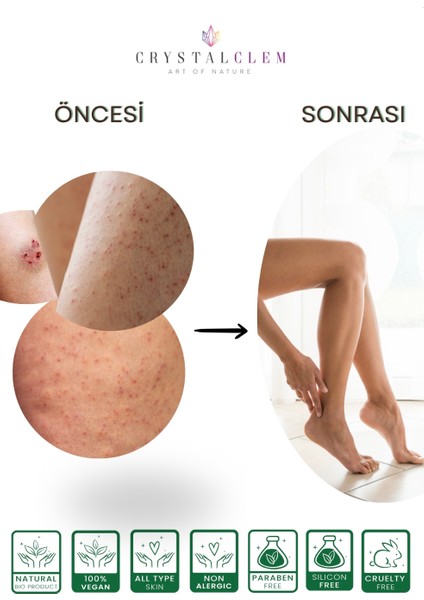 Vücut Peelingi Body Scrup Forest Batıkları Önler Arındırır fırsatları