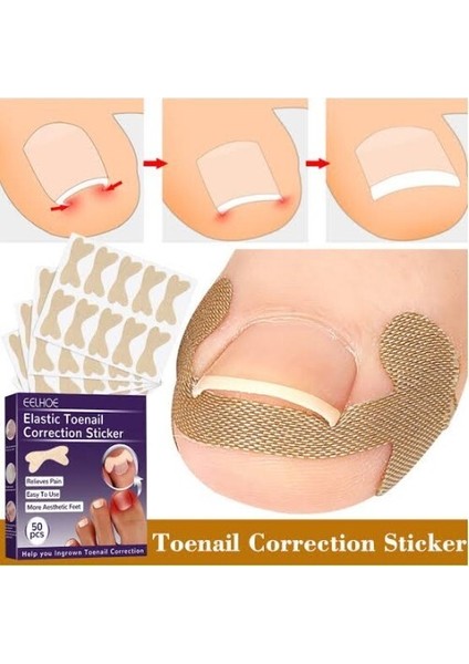 Ayak Tırnağı Düzeltme Bandı 50 Adet modelleri