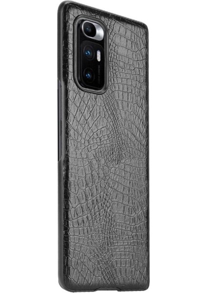 Xiaomi Mi Mix Kat Klasik Timsah Moda Anti Için Şık Klasik Durumda (Yurt Dışından)