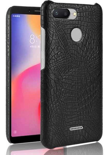 Xiaomi Redmi 6 Anti Scratch Koruyucu Kapak Için Şık Klasik Durumda (Yurt Dışından)