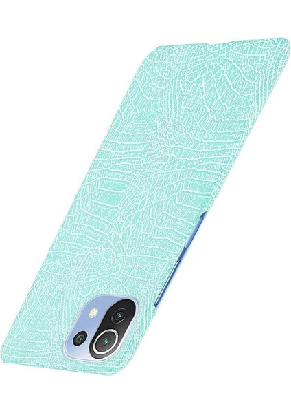 Xiaomi Mi 11 Lite Klasik Timsah Moda Kapak Için Şık Klasik Durumda (Yurt Dışından) fiyatları