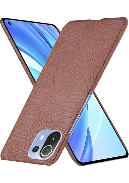 Xiaomi Mi 11 Lite Klasik Timsah Moda Kapak Için Şık Klasik Durumda (Yurt Dışından) modelleri