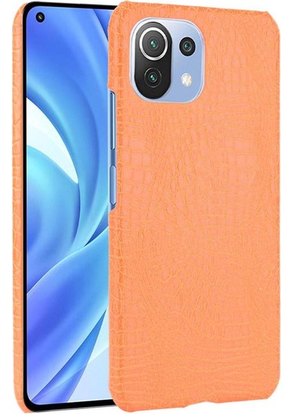 Xiaomi Mi 11 Lite Klasik Timsah Moda Kapak Için Şık Klasik Durumda (Yurt Dışından)