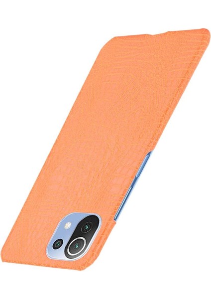 Xiaomi Mi 11 Lite Klasik Timsah Moda Kapak Için Şık Klasik Durumda (Yurt Dışından) fiyatları