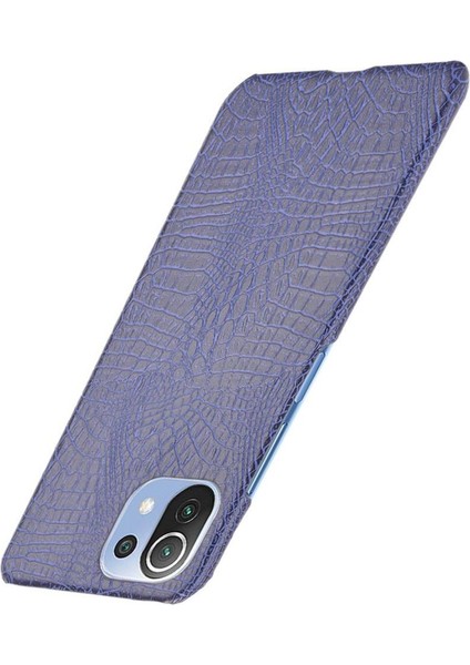 Xiaomi Mi 11 Lite Klasik Timsah Moda Kapak Için Şık Klasik Durumda (Yurt Dışından) fırsatları