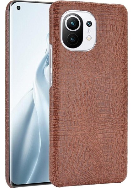 Xiaomi Mi 11 Klasik Timsah Moda Anti Kapak Için Şık Klasik Durumda (Yurt Dışından)