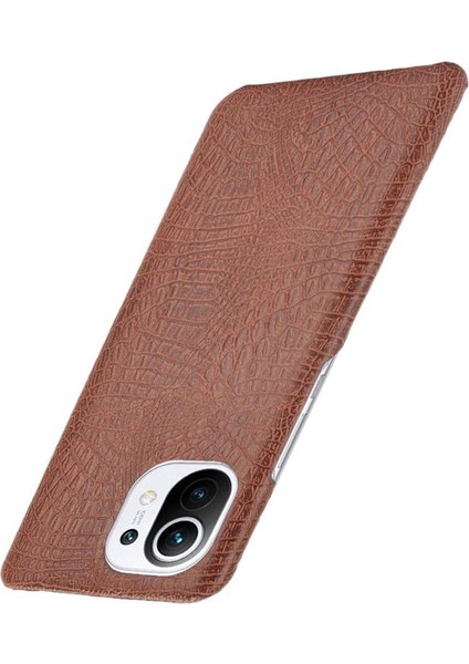 Xiaomi Mi 11 Klasik Timsah Moda Anti Kapak Için Şık Klasik Durumda (Yurt Dışından) modelleri