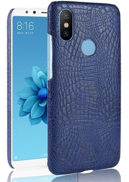 Xiaomi A2 Telefon Kılıfı (Yurt Dışından)