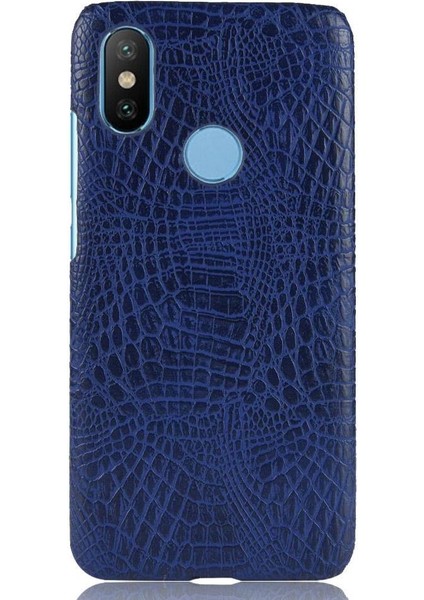 Xiaomi A2 Telefon Kılıfı (Yurt Dışından)