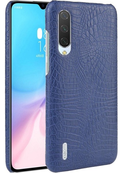 Xiaomi Redmi A3 Telefon Kılıfı (Yurt Dışından)
