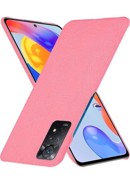 Şık Klasik Durumda Xiaomi Redmi Için Not 11 Pro 4g/5g Anti Scratch Kapak (Yurt Dışından) fiyatları