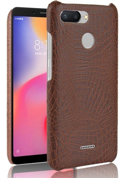 Xiaomi Redmi 6 Anti Scratch Koruyucu Kapak Için Şık Klasik Durumda (Yurt Dışından)
