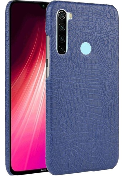 Xiaomi Redmi Not 8t Anti Scratch Koruyucu Için Şık Klasik Durumda (Yurt Dışından)