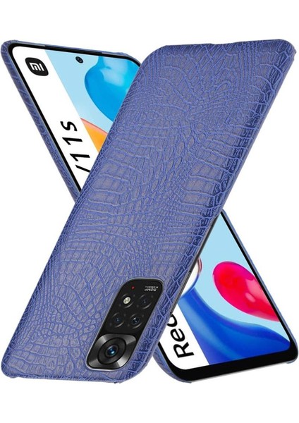 Xiaomi Redmi Not 11 Için Şık Klasik Durumda 4g /11S Anti Scratch Kapak (Yurt Dışından)