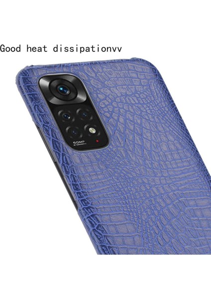Xiaomi Redmi Not 11 Için Şık Klasik Durumda 4g /11S Anti Scratch Kapak (Yurt Dışından)