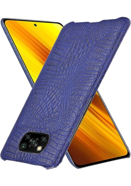 Şık Klasik Durumda Xiaomi Poco X3 Nfc Klasik Timsah Moda Anti (Yurt Dışından)