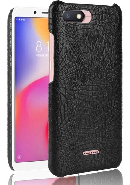 Xiaomi Redmi 6A Koruyucu Kapak Anti Scratch Için Şık Klasik Durumda (Yurt Dışından)