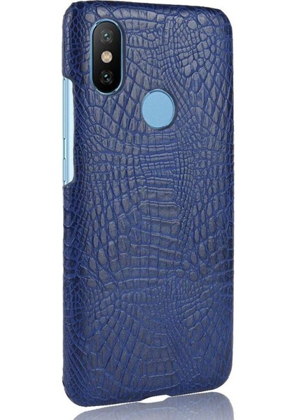 Şık Klasik Durumda Xiaomi Mi A2 Lite /redmi 6 Pro Anti Scratch Kapak (Yurt Dışından)