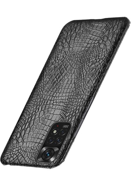 Xiaomi Redmi Not 11 Için Şık Klasik Durumda 4g /11S Anti Scratch Kapak (Yurt Dışından)