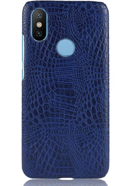 Şık Klasik Durumda Xiaomi Mi A2 Lite /redmi 6 Pro Anti Scratch Kapak (Yurt Dışından) modelleri