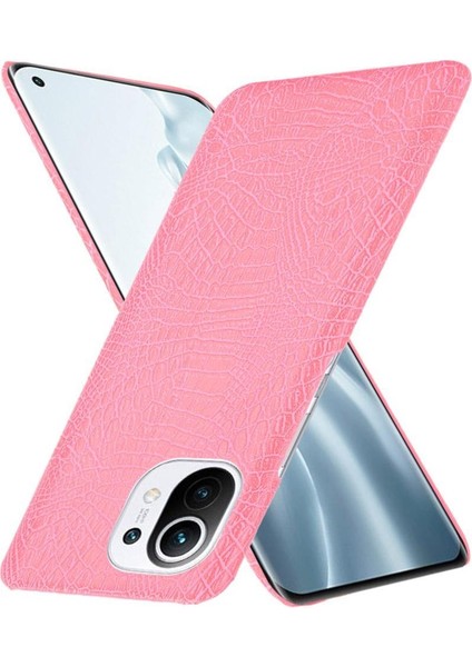 Xiaomi Mi 11 Klasik Timsah Moda Anti Kapak Için Şık Klasik Durumda (Yurt Dışından) fırsatları