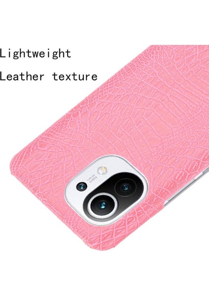 Xiaomi Mi 11 Klasik Timsah Moda Anti Kapak Için Şık Klasik Durumda (Yurt Dışından) indirimleri