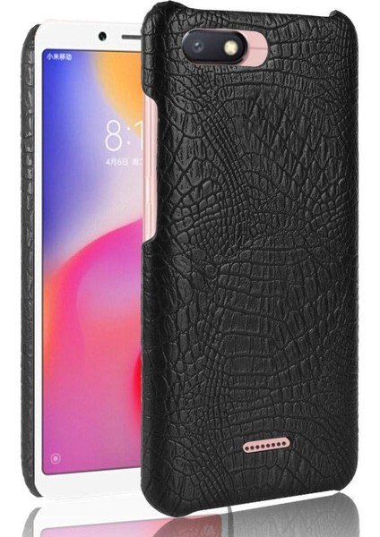 Xiaomi Redmi 6A Koruyucu Kapak Anti Scratch Için Şık Klasik Durumda (Yurt Dışından)