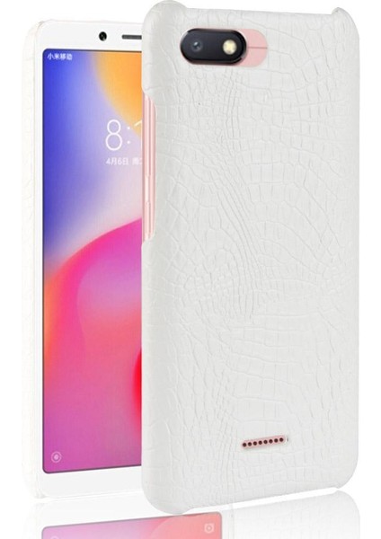 Xiaomi Redmi 6A Koruyucu Kapak Anti Scratch Için Şık Klasik Durumda (Yurt Dışından)