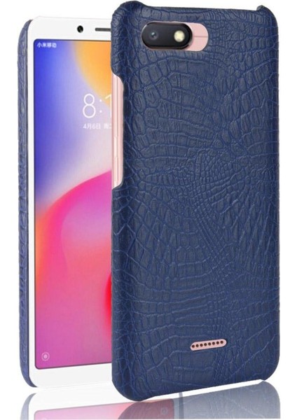 Xiaomi Redmi 6A Koruyucu Kapak Anti Scratch Için Şık Klasik Durumda (Yurt Dışından)