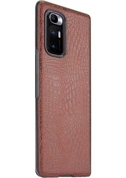 Xiaomi Mi Mix Kat Klasik Timsah Moda Anti Için Şık Klasik Durumda (Yurt Dışından) fırsatları