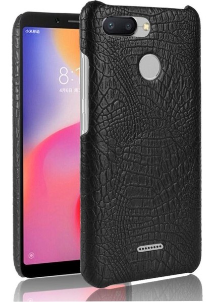Xiaomi Redmi 6 Anti Scratch Koruyucu Kapak Için Şık Klasik Durumda (Yurt Dışından)