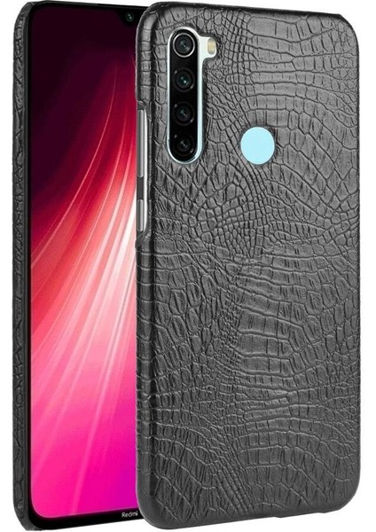Xiaomi Redmi Not 8t Anti Scratch Koruyucu Için Şık Klasik Durumda (Yurt Dışından)