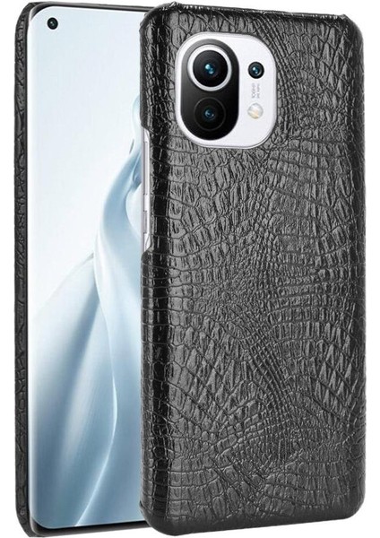 Xiaomi Mi 11 Klasik Timsah Moda Anti Kapak Için Şık Klasik Durumda (Yurt Dışından)