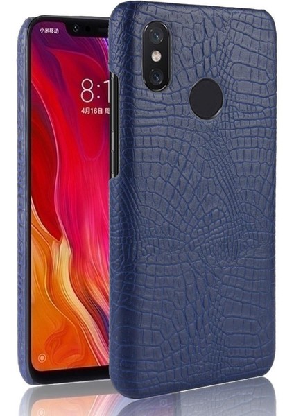 Xiaomi Mi 8 Se Anti Scratch Uyumluluk Kapak Için Şık Klasik Durumda (Yurt Dışından)