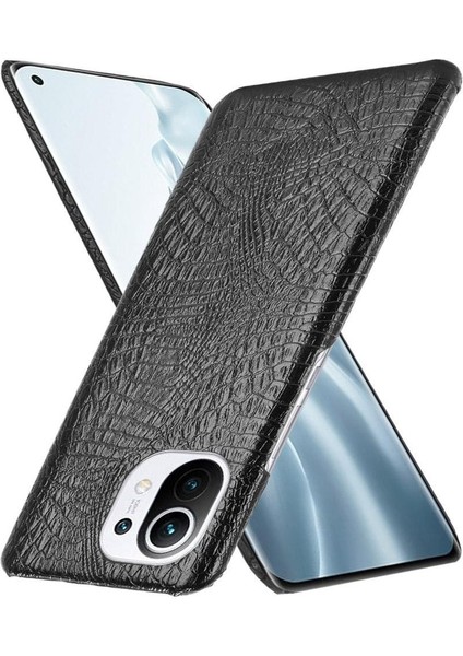 Xiaomi Mi 11 Klasik Timsah Moda Anti Kapak Için Şık Klasik Durumda (Yurt Dışından) fırsatları