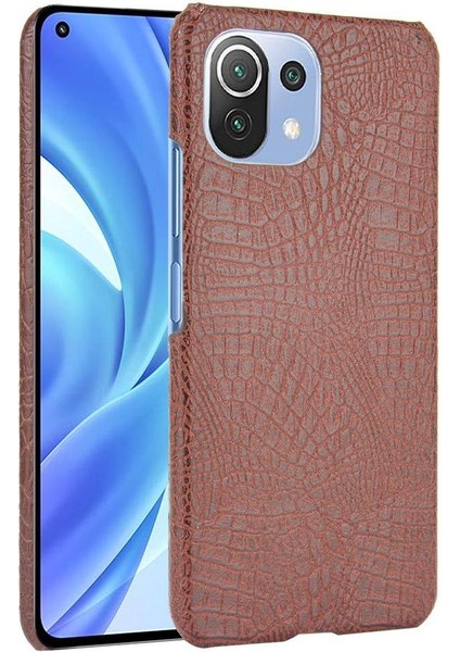 Xiaomi Mi 11 Lite Klasik Timsah Moda Kapak Için Şık Klasik Durumda (Yurt Dışından)